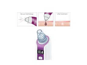 Pooride puhastaja Beurer